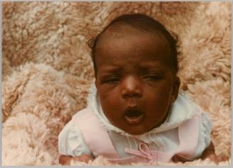 [Close-up of baby's face, they are lying on a fur-like fabric]