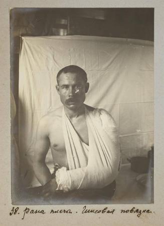 Shoulder wound. Cast.