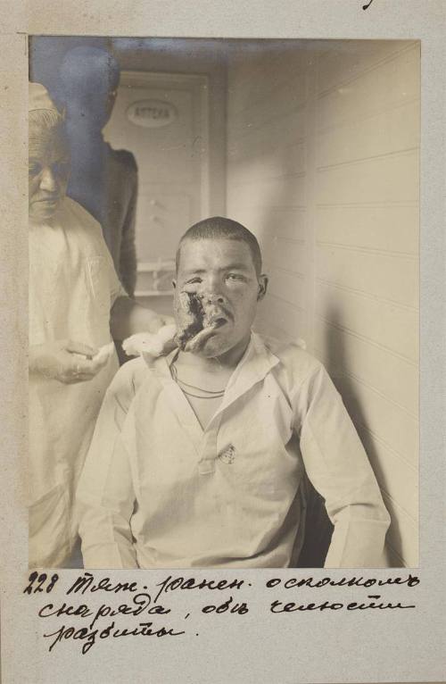 Seriously wounded by shrapnel, both jaws severely wounded