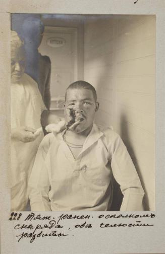 Seriously wounded by shrapnel, both jaws severely wounded