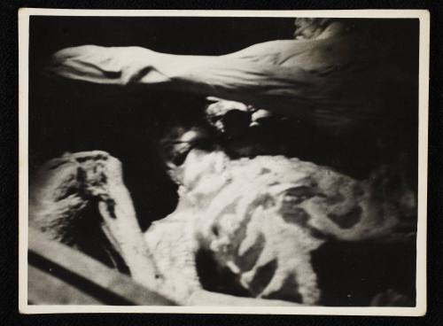 Skeletal ribs and limb in the morgue