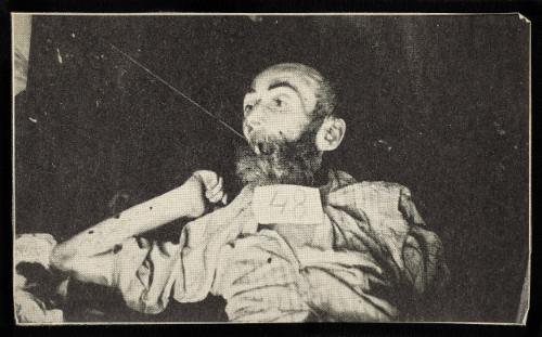 Body for burial tagged '48' - bald man with beard